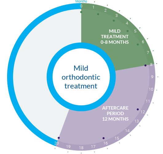 OrthoMap - Mild orthodontic treatment