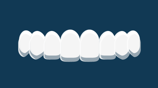 Types of braces | Ortho Dublin and Dundalk - Invisalign